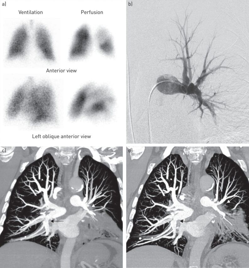 FIGURE 1