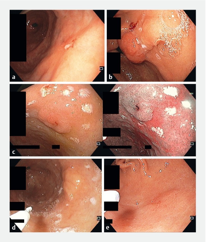 Fig. 2