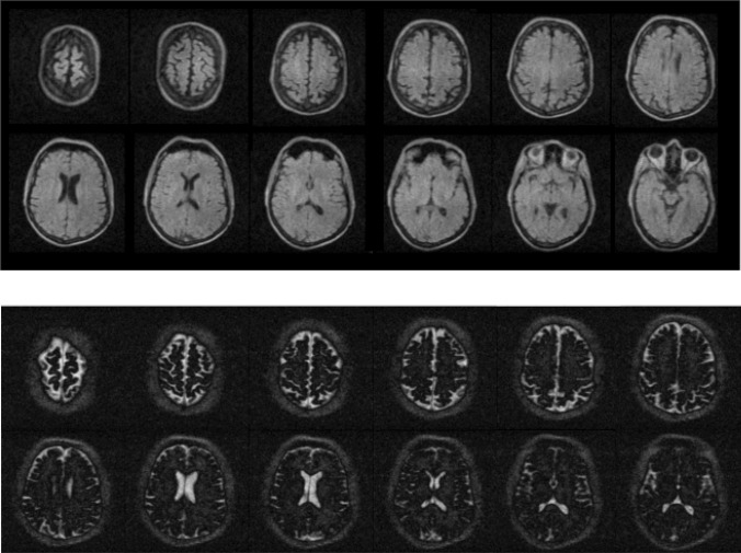 Fig. 13