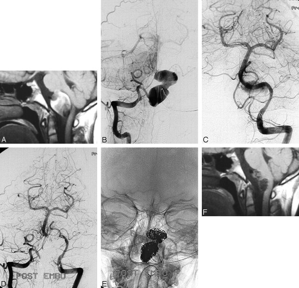 Fig 3.