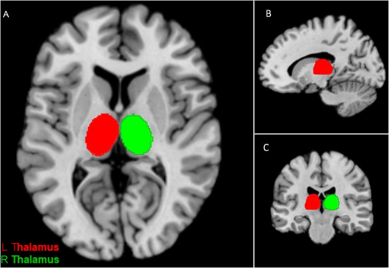 Fig. 2