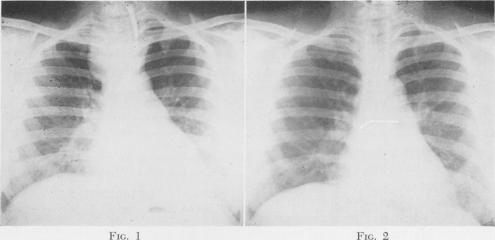 Fig. 1, Fig. 2