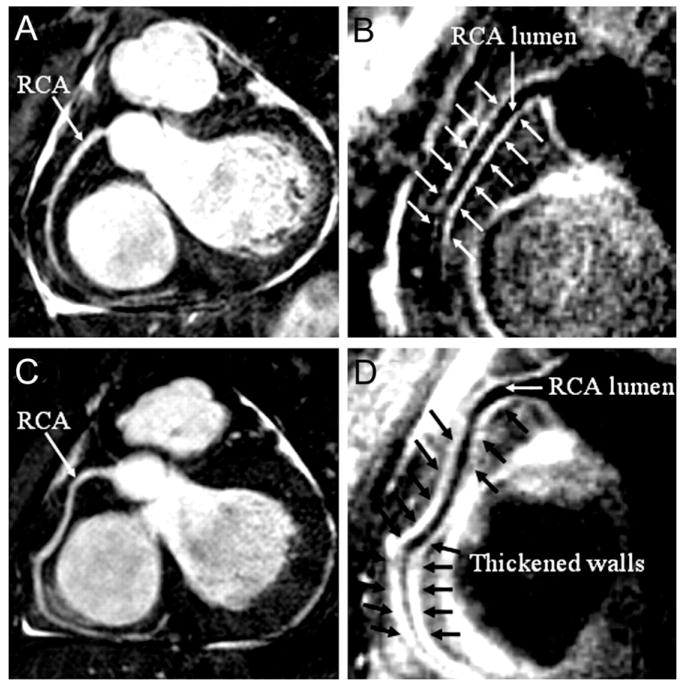 FIG 23