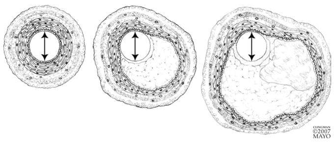 FIG 3