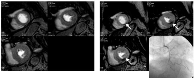 FIG 20