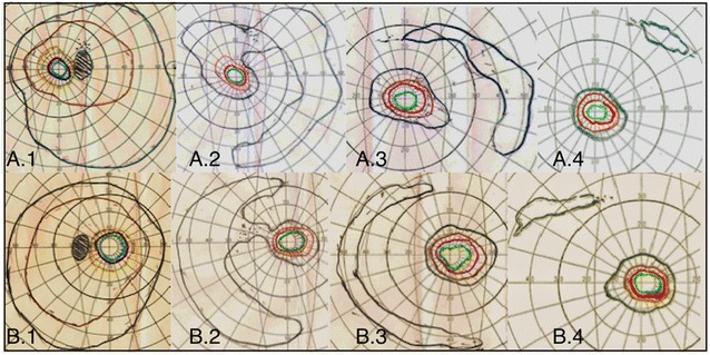 Fig. 4