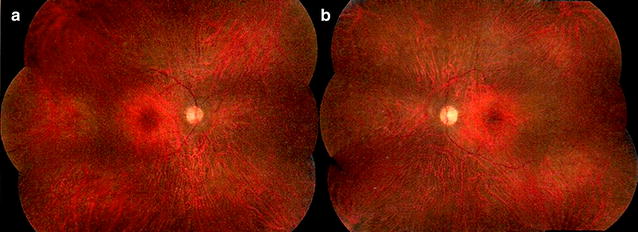 Fig. 1