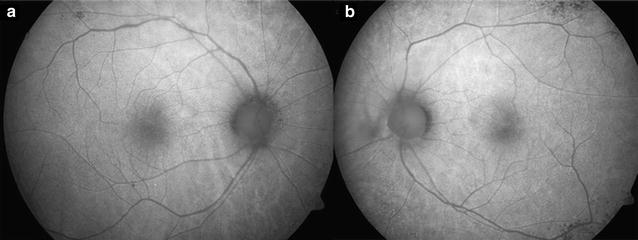 Fig. 2