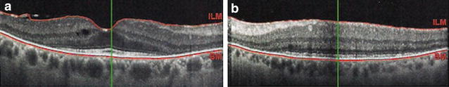 Fig. 3