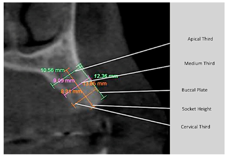 Figure 14