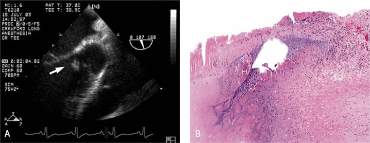 FIG 4