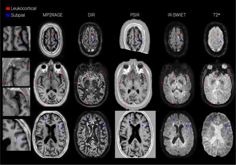 Fig. 2