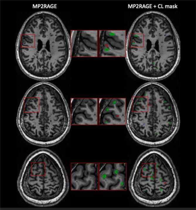 Fig. 6