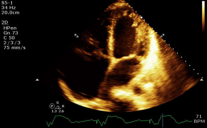 Figure 5