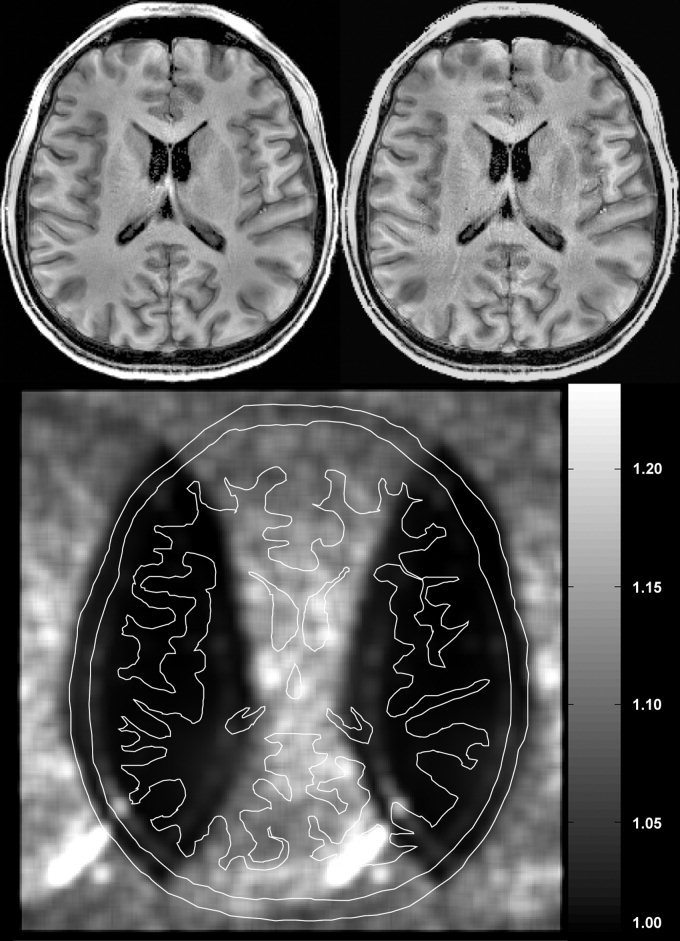 Figure 11