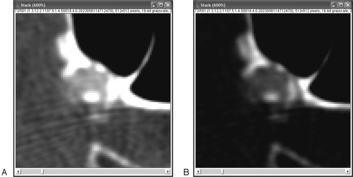 Fig 3.