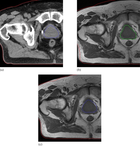 Figure 11