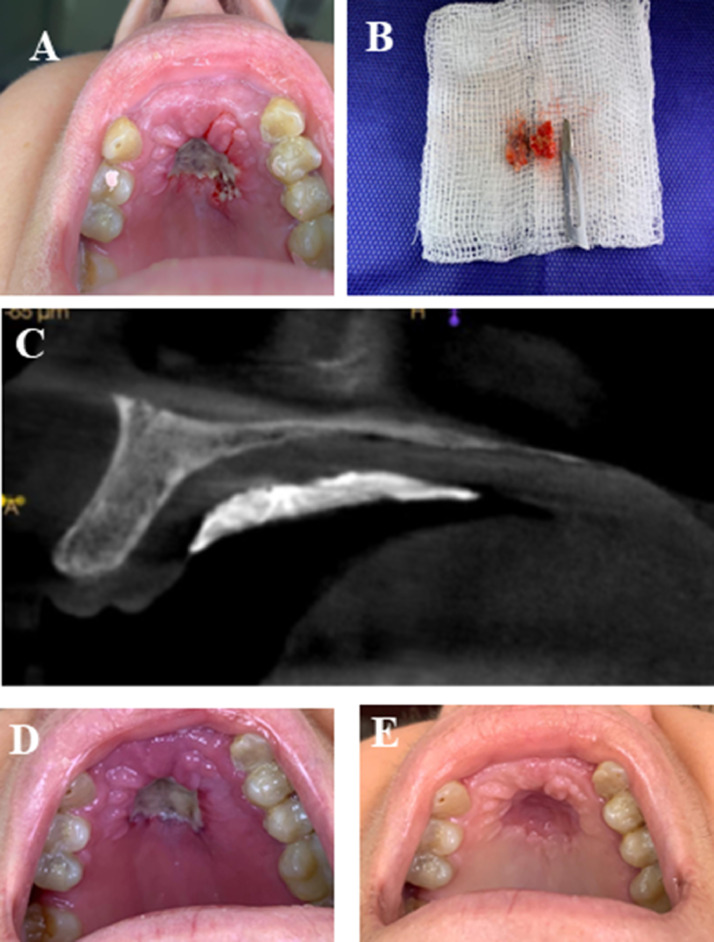 Fig 1