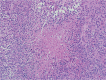 Figure 1B