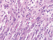 Figure 1A