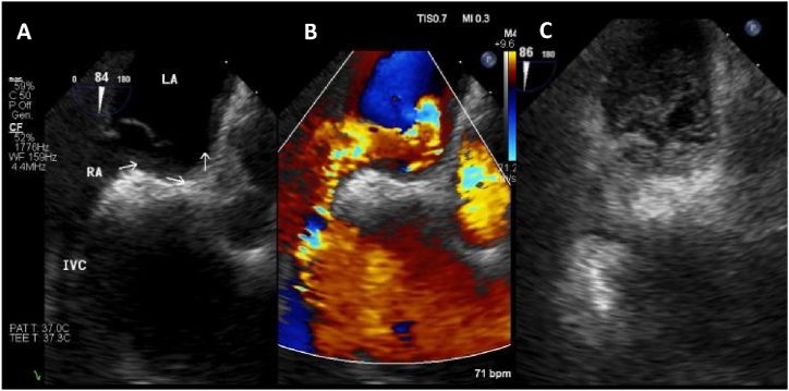 Fig. 2