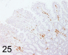 Fig. 25.