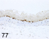 Fig. 77.