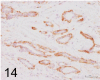 Fig. 14.