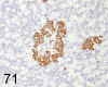 Fig. 71.