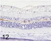 Fig. 12.