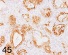 Fig. 45.