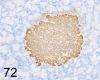 Fig. 72.