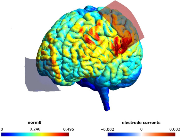 FIGURE 1