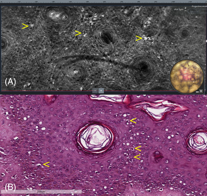 FIGURE 3