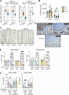 Figure 6. Activation of β-catenin decreases Hnf4a and Hnf4g expressions. A, Expressions of HNF4A and HNF4G in normal human colonic tissue and tumor tissue from TCGA (n = 19 normal, 101 tumor) and Skrypczak (n = 24 normal, 45 tumor) datasets. Data are presented as median ± minimum/maximum. *, P < 0.05 (Mann–Whitney U test). B, Hnf4a and Hnf4g expressions are determined by RNA-seq analysis of SI in WT (n = 9), VAF/F (n = 36), and VAF/FK (n = 17) mice. Each dot represents one mouse. C, Images of HNF4A and HNF4G protein expressions in SI of indicated models (n = 4); scale bar, 500 μm. D, Images of intestinal tissue from tumor-bearing VA mice stained for indicated proteins; scale bar, 500 μm. E, Fold change in expression levels of Hnf4a and Hnf4g in organoids from various genotypes measured at indicated days after tamoxifen treatment. Each dot represents one organoid from one mouse (n = 3). F, Fold change in expression levels of Hnf4a and Hnf4g in WT organoids treated with 3 or 10 μmol/L CHIR-99021 for indicated days. Each dot represents one organoid from one mouse (n = 3). Data are presented as mean ± SD. **, P < 0.01; ***, P < 0.001 (one-way ANOVA followed by Dunnett post hoc test).