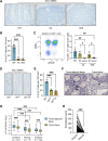 Figure 2. γδ T cells are excluded from mouse and human gut tumors. A, Images of SI tissue from 4 WT (Cre-negative), tumor-bearing Villin-CreERT2;ApcF/+ (VA) and tumor-bearing Villin-CreERT2;ApcF/+;KrasG12D (VAK) mice stained for Trdc mRNA; scale bar, 500 μm. B, γδ T-cell numbers in SI tissue of indicated models. Each dot represents one mouse (n = 11 WT, 3 VA, 3 VAK). C, Representative flow cytometry plot of CD8α and γδTCR expressions on total CD3+ cells in the small intestine of WT mice. CD8α+ γδ T-cell frequency in SI of indicated models. Each dot represents one mouse (n = 9 WT, 4 VA, 5 VAK). D, Images of SI from indicated models (n = 4/group) stained for Trdc mRNA; scale bar, 500 μm. E, γδ T-cell numbers in SI of indicated models. Each dot represents one mouse (n = 3 WT, 4 VAF/F, 4 VAF/FK). F, Image of γδ T-cell staining in tumor adjacent tissue and tumor tissue from human colon cancer sections (Scotland cohort, n = 141) where arrows indicate positively stained cells; scale bar, 500 μm. G, Density of γδ T cells in human colon cancer sections in three different patient cohorts: Scotland (n = 141), Norway (n = 71), and Thailand (n = 122). γδ T cells identified by IHC in full sections were quantified in tumor adjacent tissue or tumor tissue using Visiopharm. Data are presented as median ± min/max. H, Expressions of TRGV4 and TRGV9 mRNA in human colon cancer samples (n = 82) from the Scotland cohort determined by TempO-Seq. Data are presented as mean ± SD. *, P < 0.05; **, P < 0.01; ***, P < 0.001 (paired t test or one-way ANOVA followed by Dunnett post hoc test).