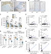 Figure 3. Expression of butyrophilin-like molecules is reduced in gut tumors. A, Images of intestinal tissue from indicated models (n = 4) stained for Btnl1 mRNA. T, tumor; scale bar, 100 μm. B, Images of intestinal tissue from indicated models (n = 4) stained for Btnl1 mRNA; scale bar, 100 μm. C, Butyrophilin-like mRNA expression shown by bar graph generated from RNA-seq data from WT (n = 9), VAF/F (n = 36), and VAF/FK (n = 17) mice. Data are presented as mean ± SD. D, Expressions of BTNL3 and BTNL8 in normal human colonic tissue and tumor tissue from TCGA (n = 19 normal, 101 tumor; ref. 9) and Skrypczak (n = 24 normal, 45 tumor; ref. 27) datasets. Data are presented as median ± min/max. E–G, Correlation between indicated molecules as determined by TempO-Seq and γδ T-cell density determined by IHC in the Scotland cohort from 77 matched pairs. Units on axes are normalized read counts x 103. Each dot represents one tumor. P and r values determined by Pearson correlation. *, P < 0.05; **, P < 0.01; ***, P < 0.001 (Mann–Whitney U test or one-way ANOVA followed by Tukey post hoc test).