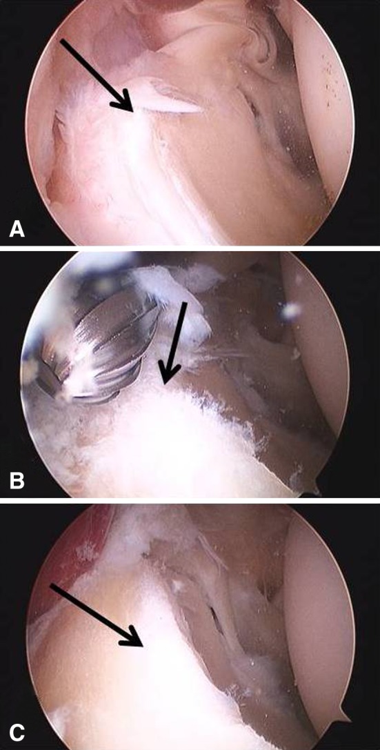 Fig. 5A–C