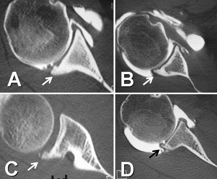 Fig. 2A–D