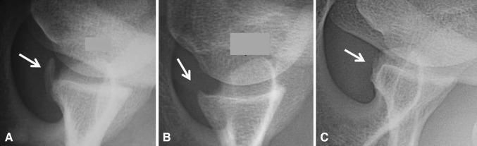 Fig. 8A–C