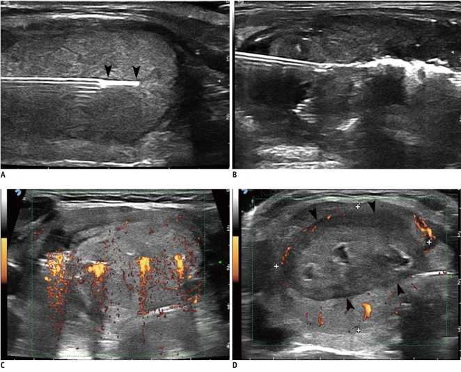 Fig. 13