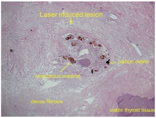 Fig. 11