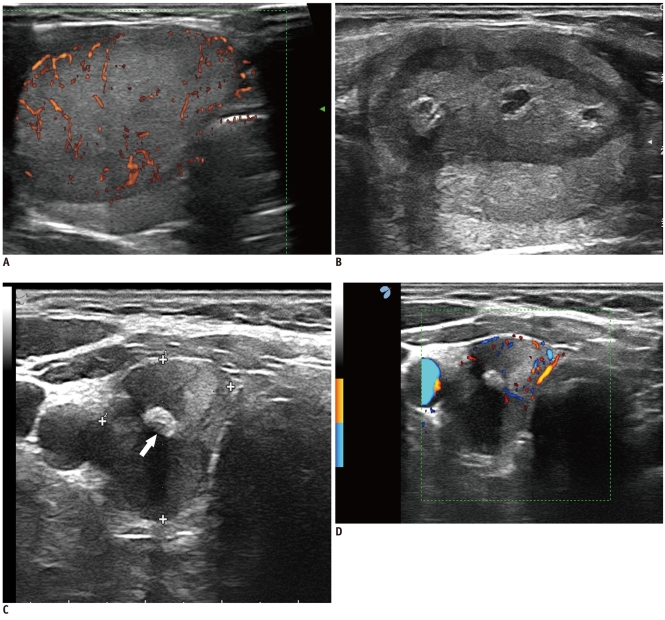 Fig. 14