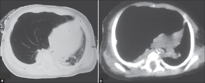 Figure 1 (a and b)