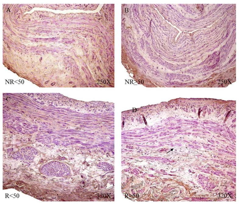 Figure 17