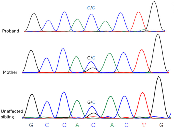 FIGURE 2