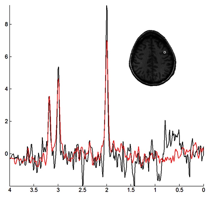 Figure 2: