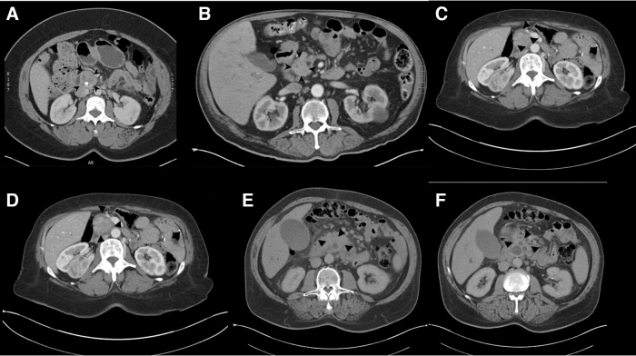 FIG. 1.