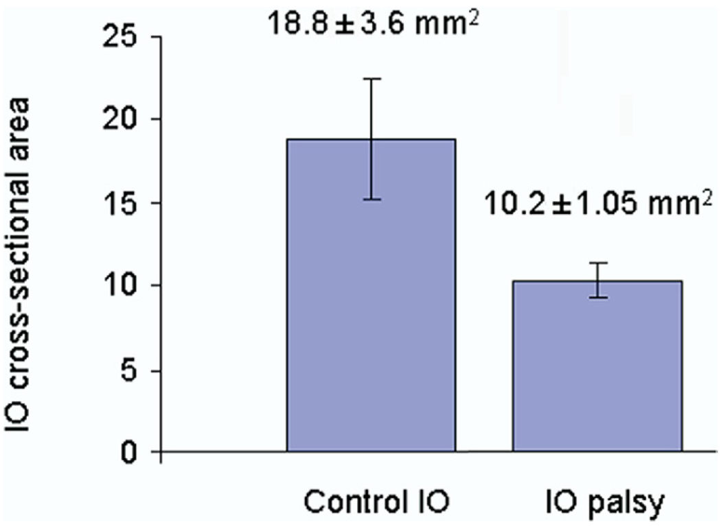 FIG 3