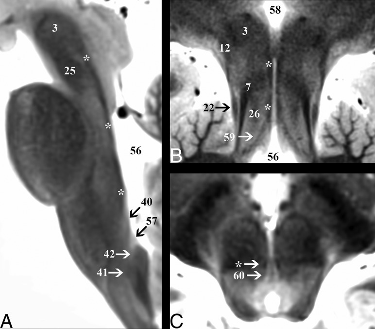 Fig 5.